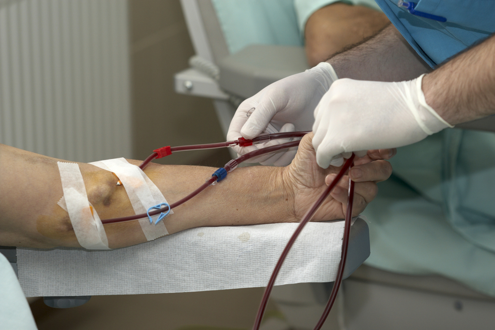 #dobrepraktyki: Jak jedna z naszych pacjentek pokonała hiperfosfatemię